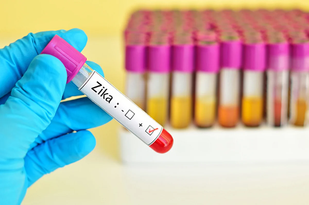 Karnataka Reported 1st Confirmed Case of Zika Virus