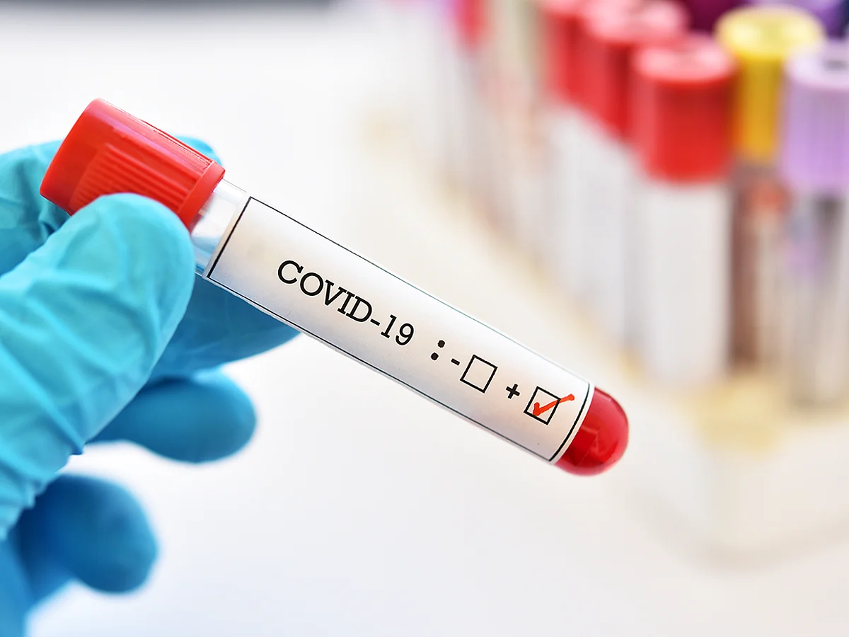 Assam: 141 New COVID-19 Cases, Positivity Rate At 0.45 %