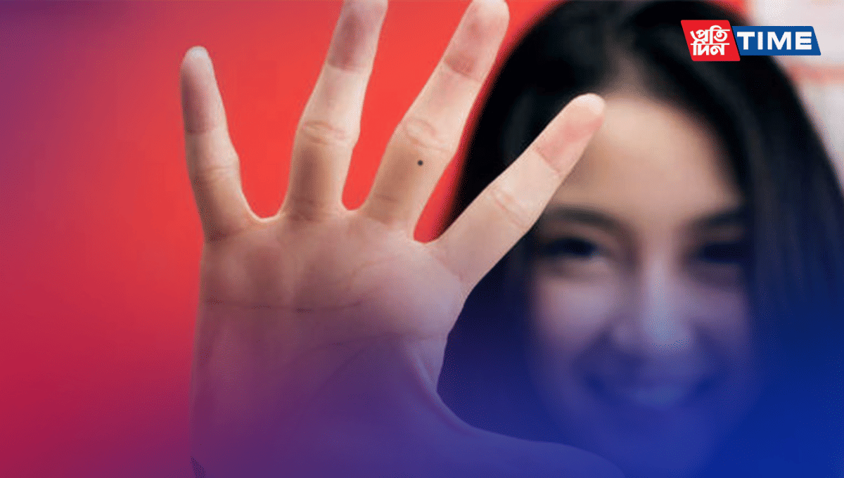 Mole On Your Palm