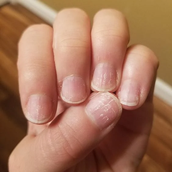 nail1