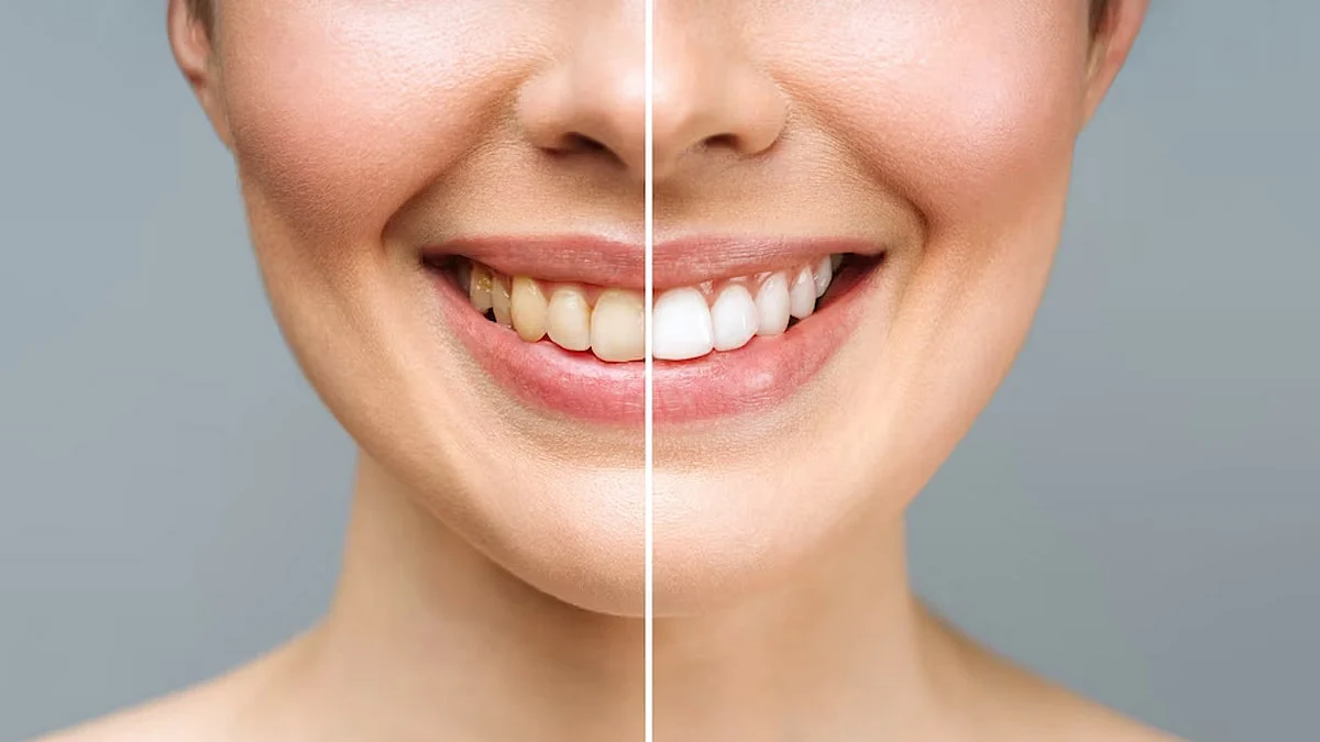 how to get white teeth