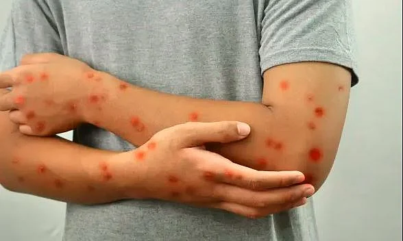 VIRUS 1
