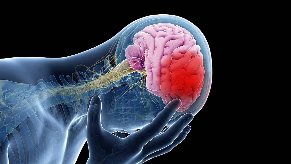 stroke 1820102919070614