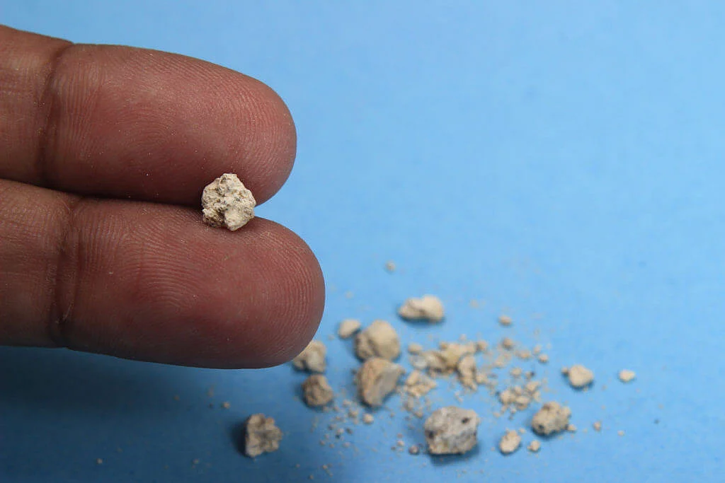 close up of small kidney stones between two fingers