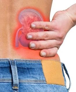 Kidney