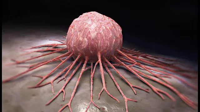 cancertumor1531397920