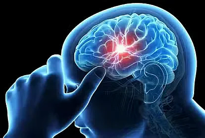brain tumor1566984812