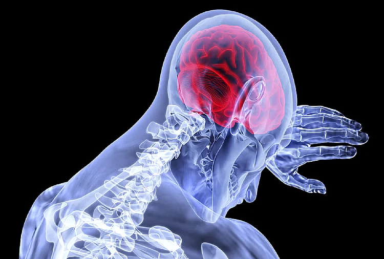 brain stroke 1589091076