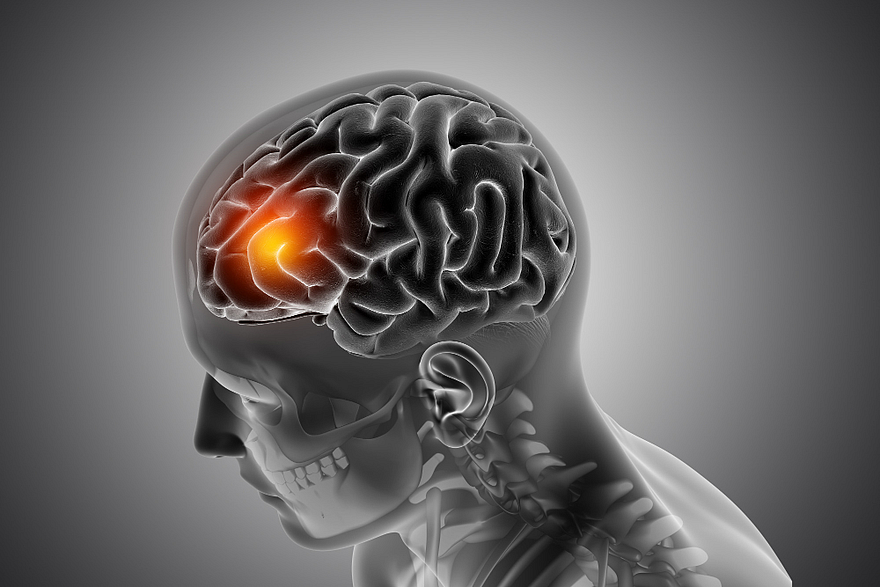 Braintumorhindi1726739591