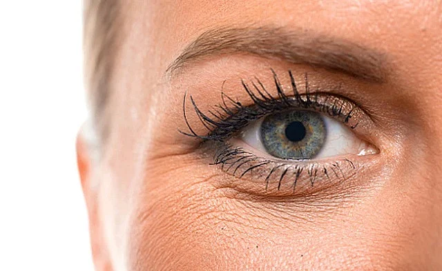 2024 11image 11 36 225888054undereyewrinkles