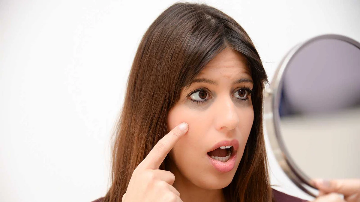 Freedom from dark circles