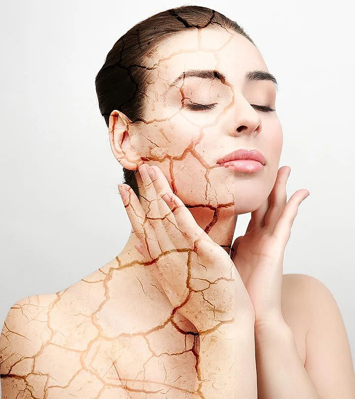 How To Use Multani Mitti For Dry Skin 1
