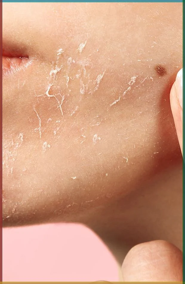 7 Tips on How to Care for Your Skin in Winter Stellar You