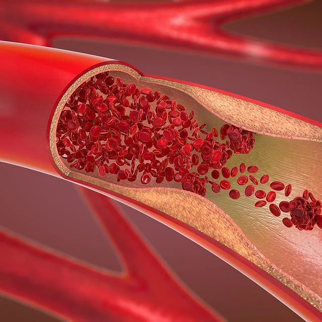 8 Signs of a Blood Clot You Should Never Ignore According to Doctors