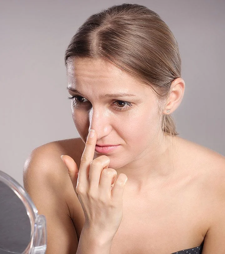 How To Remove Blackheads At Home 12 Natural Remedies To Try