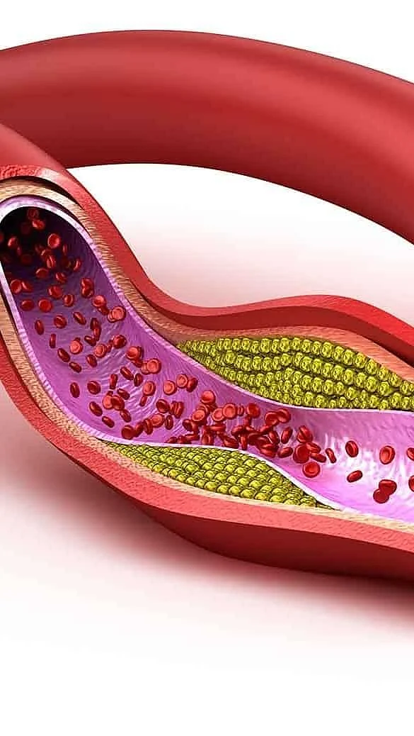 8 Benefits of garlic for cholesterol