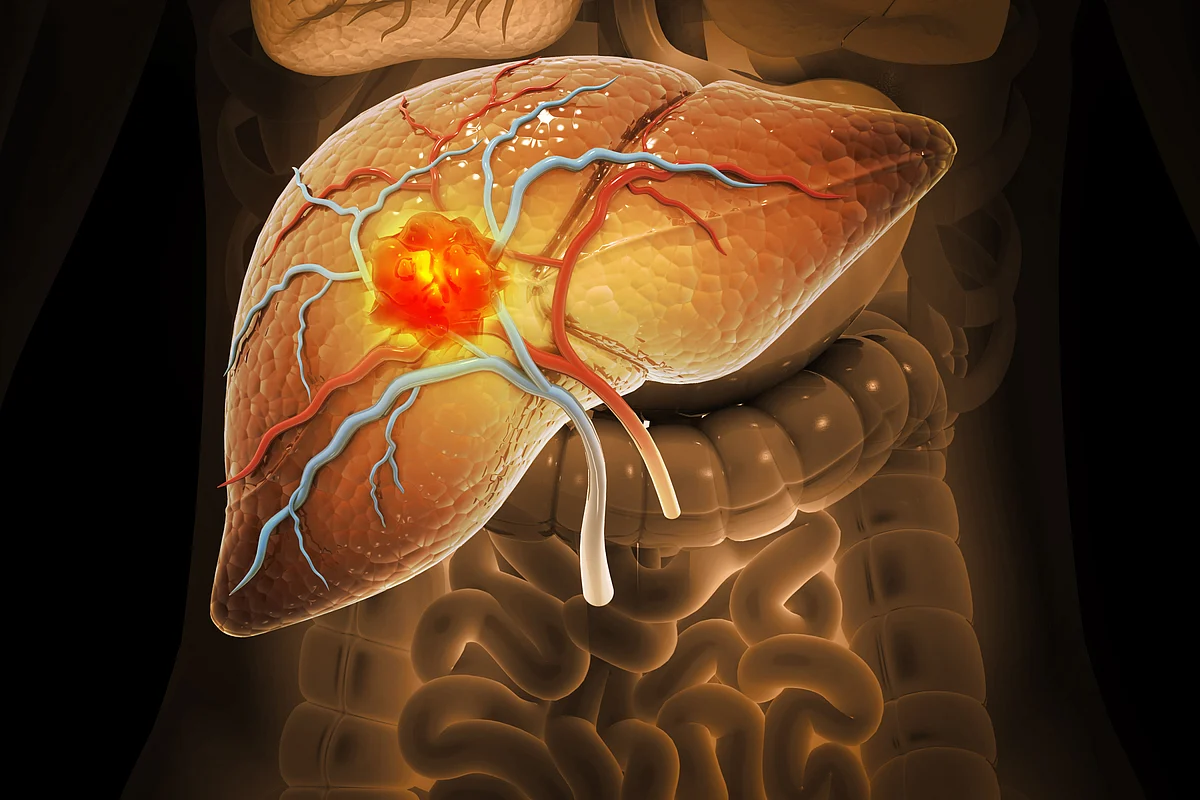 LIVER 7