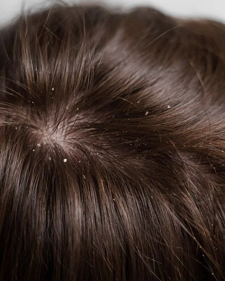 Join the Scalp Revolution 🌍🌟 Were on a mission…
