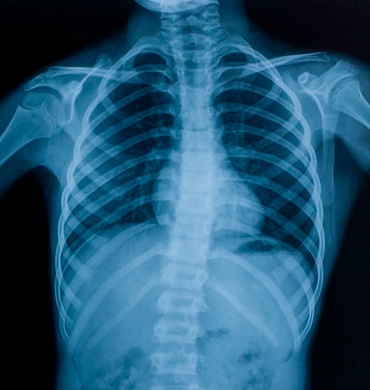 What Is a Skeletal Survey