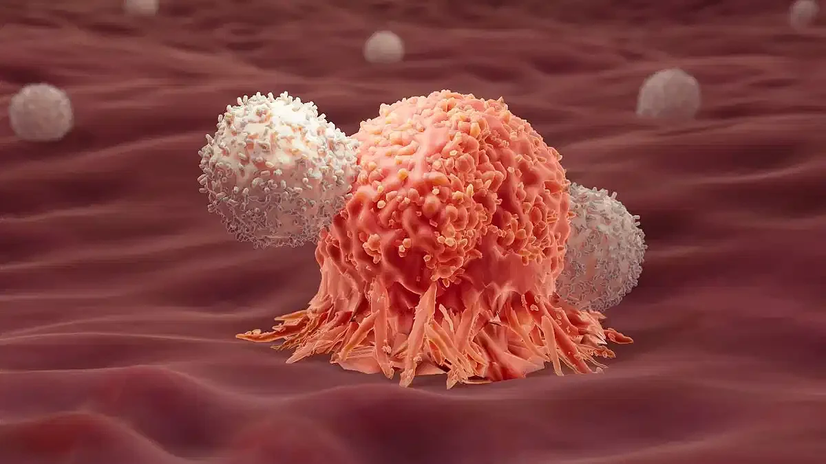 skin cancer