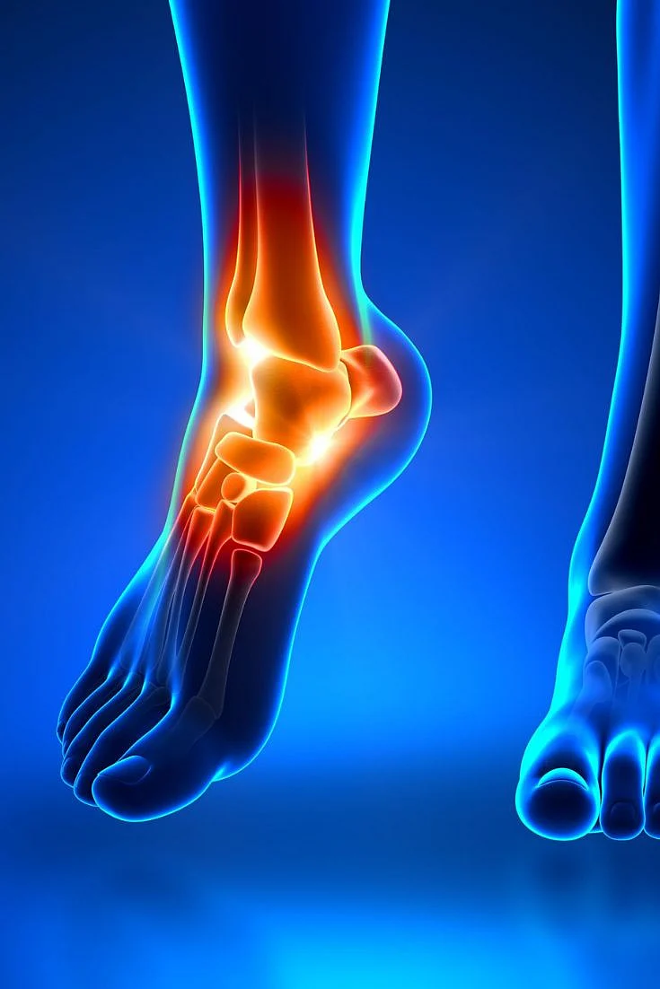 How To Treat Heel Pain Effectively