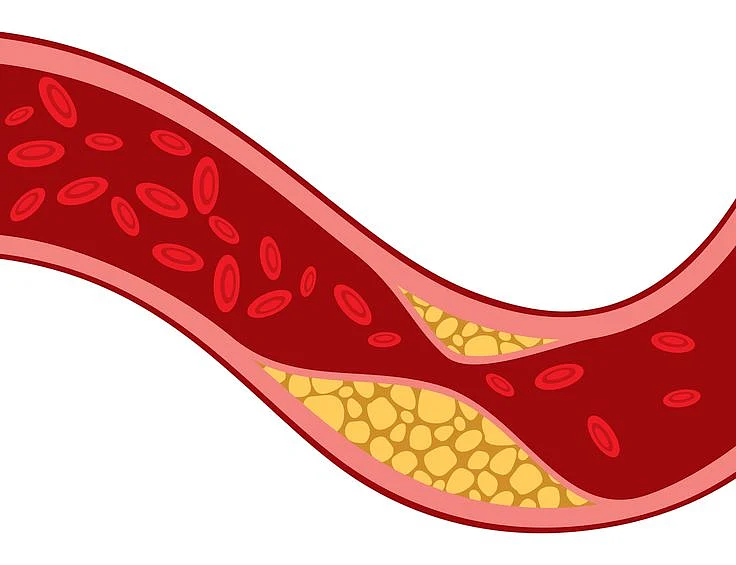 cholestrol 2