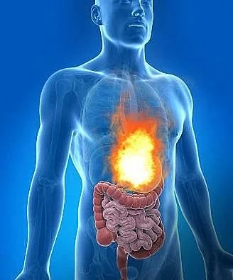 Natural Ways To Prevent Acidity And Heartburn