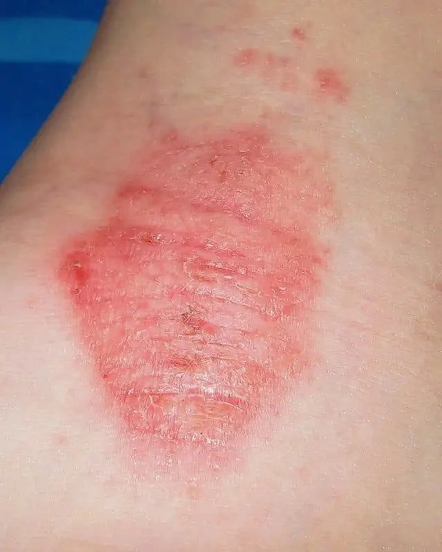 All The Ways You Didn’t Know Vaseline Can Act As Your Trusty Sidekick