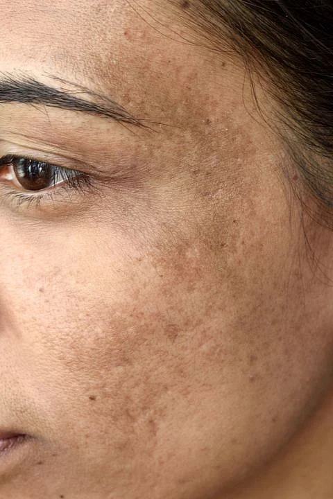 8 Common Skin Problems and How to Fix Them