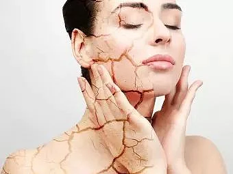 Dead Skin Under Feet Causes Symptoms And Treatment