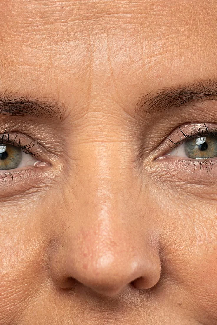 How To Get Rid Of Glabellar Lines Without Botox Top 6 Methods