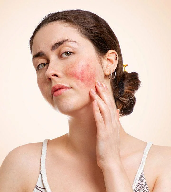 Skin Inflammation Causes Symptoms Diagnosis And Treatment