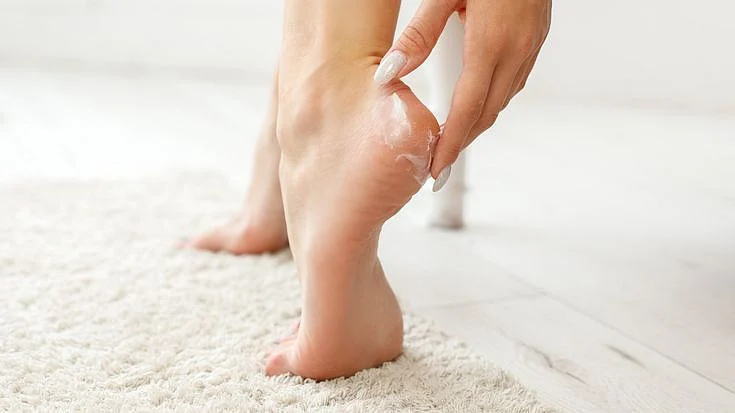 Cracked Heels cream