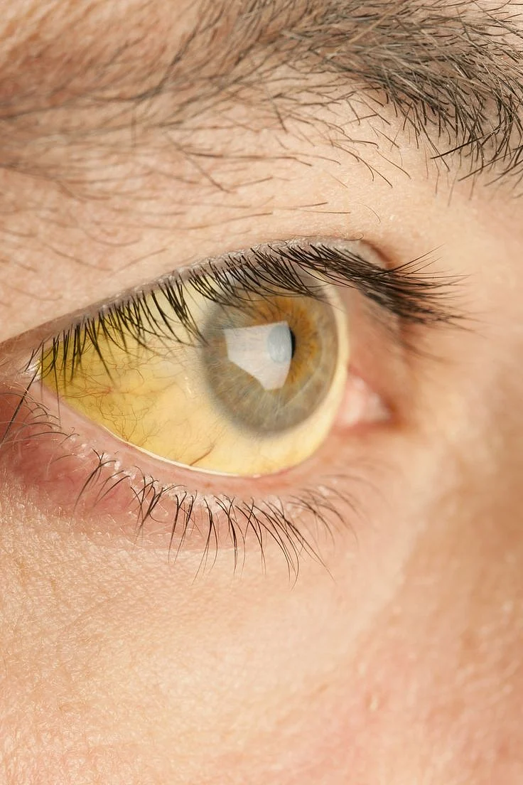 12 Things Your Eyes Are Trying to Tell You About Your Health