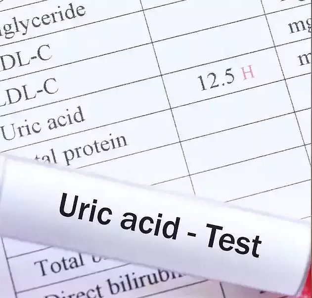 Uric Acid