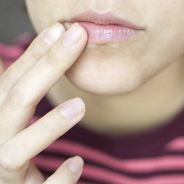 Remedies for Discoloration of the Lips