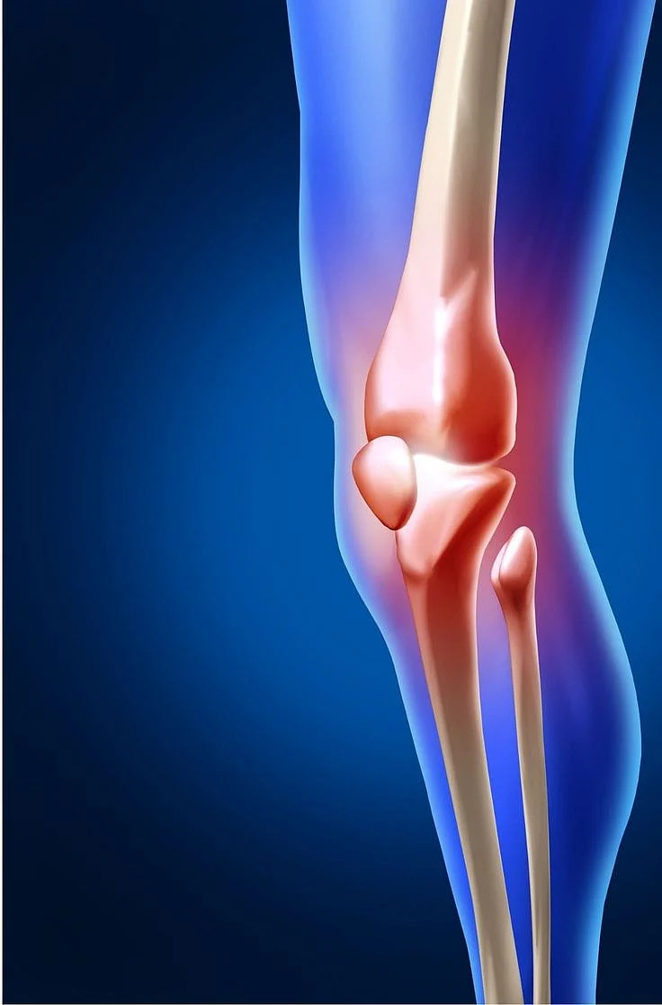 How to Increase Bone Strength Naturally Healthier Steps 2