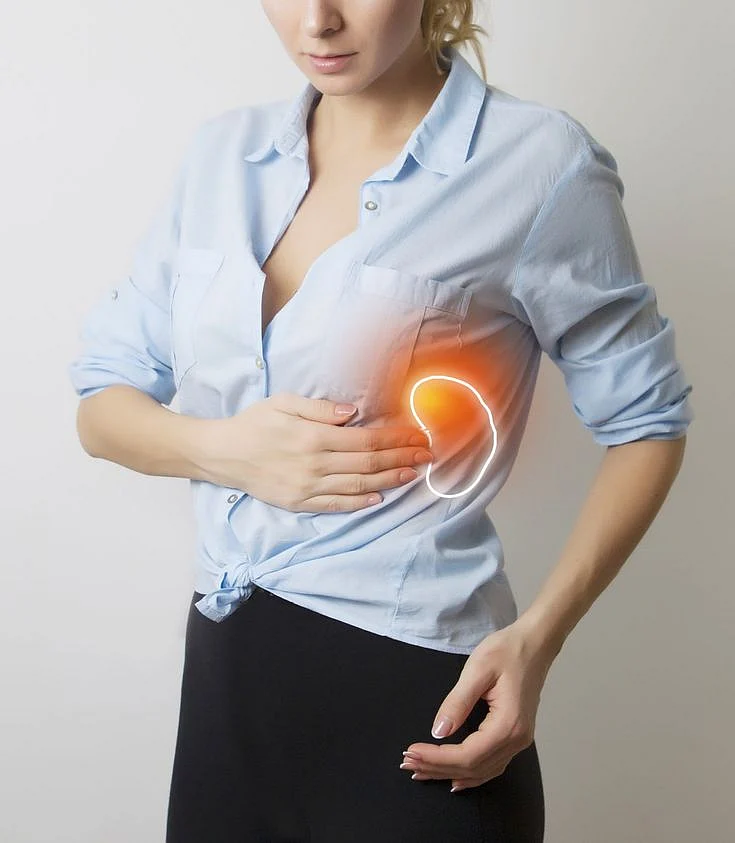 kidney failure. 4