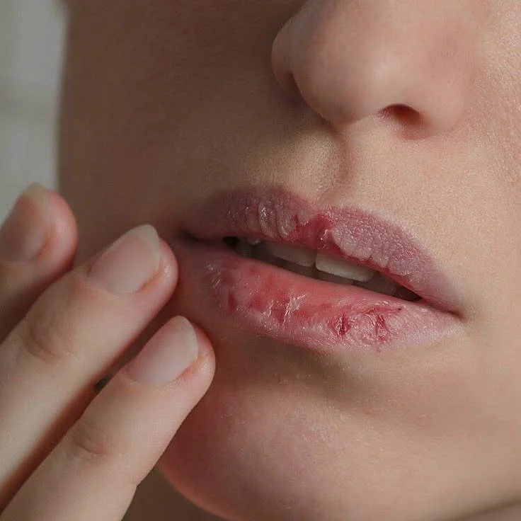 Why are your lips so dry Heres why and how to best deal with it — USA TODAY