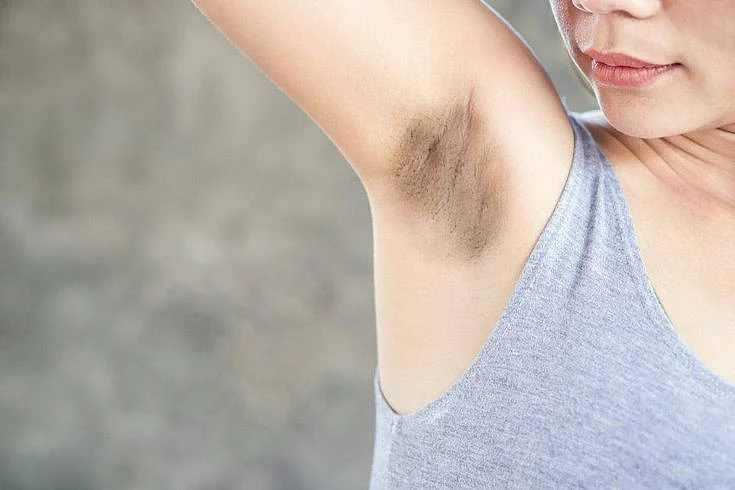Dark Underarms 4