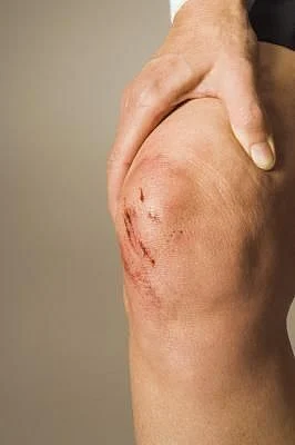 injury