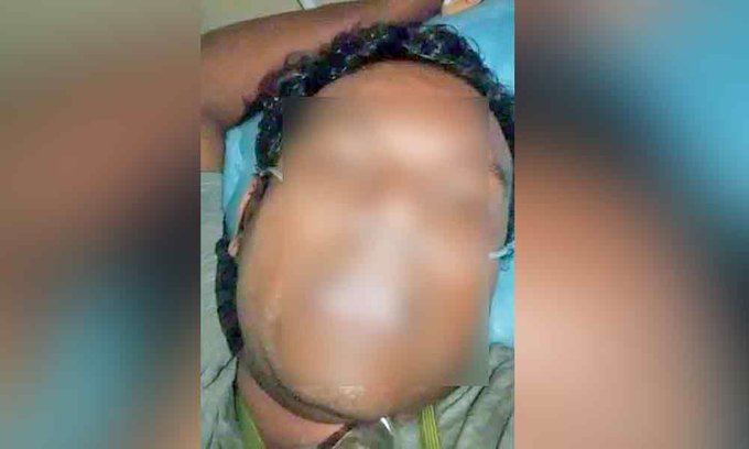 ’’انھوں نے میرا وینٹی لیٹر ہٹا دیا، میں مر رہا ہوں‘‘، مرنے سے پہلے کورونا مریض نے بنایا ویڈیو