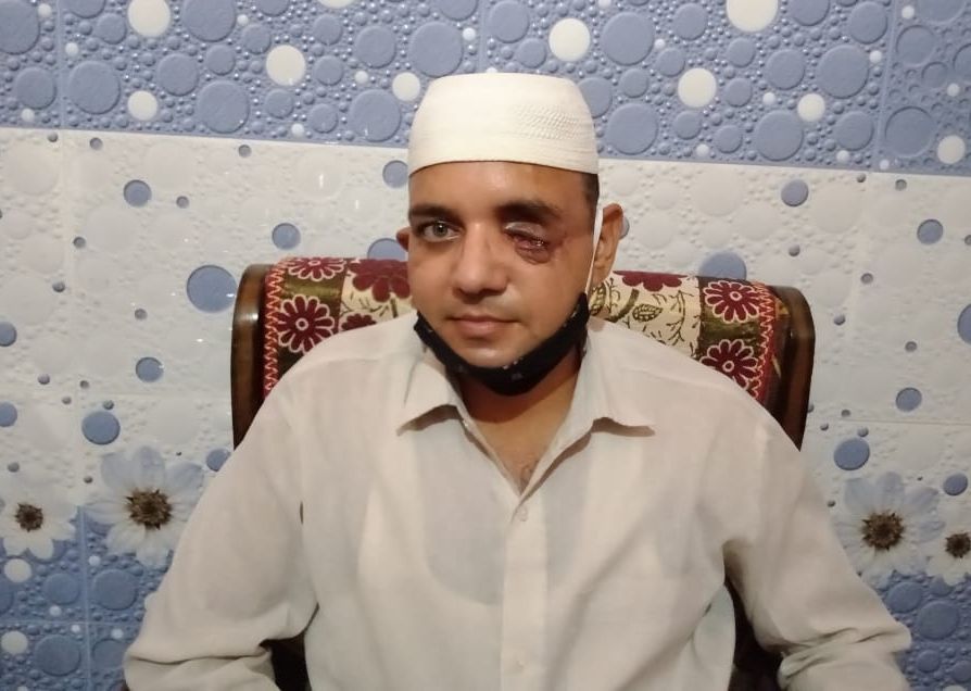 دہلی فساد میں اپنی آنکھ کھونے والے ناصر کو نہیں مل رہا انصاف