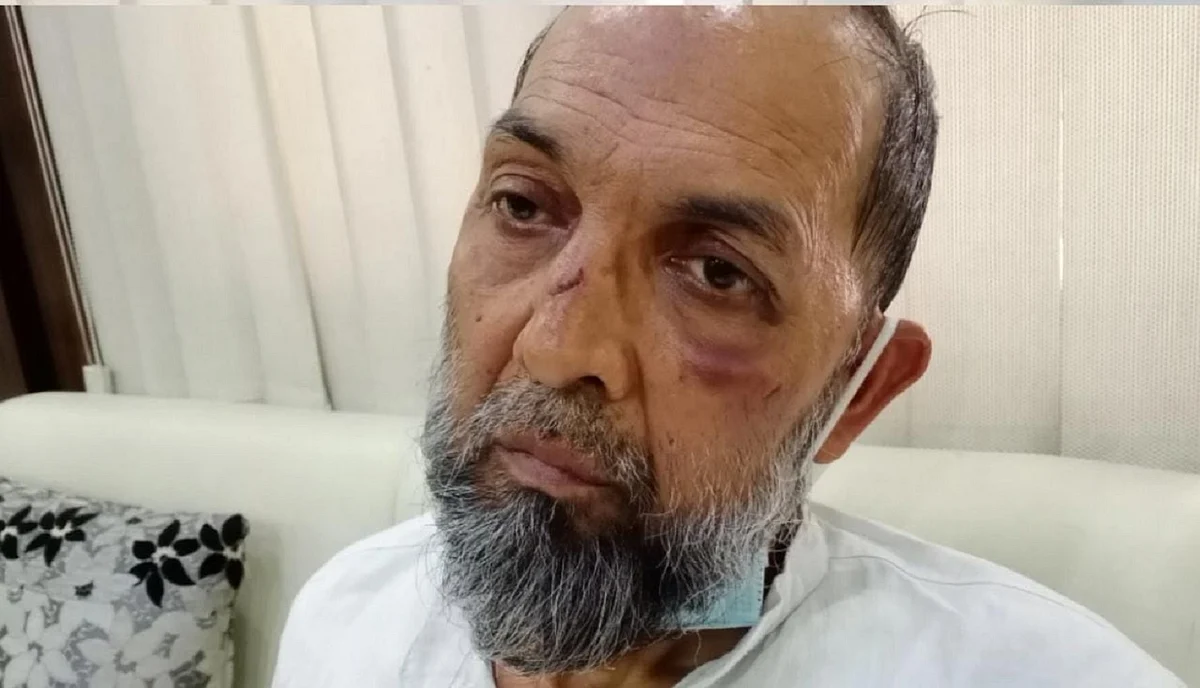 کاظم احمد کے ساتھ مار پیٹ معاملہ: سپریم کورٹ کی مداخلت، 18 ماہ بعد درج ہوا مقدمہ