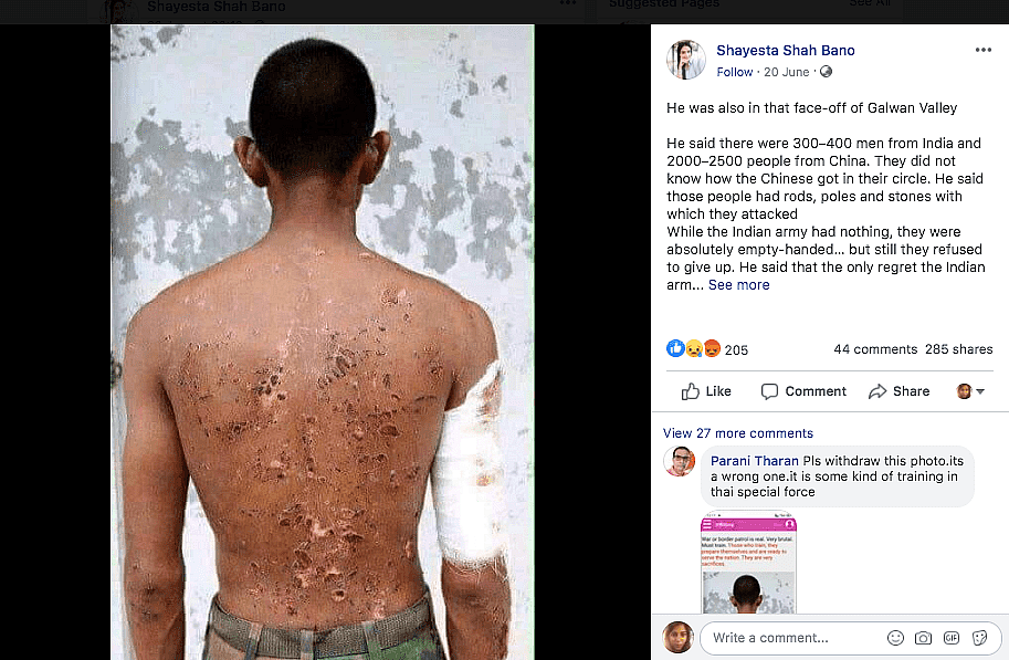 गलवान में घायल भारतीय जवान की है ये फोटो? वायरल फोटो का सच जानिए