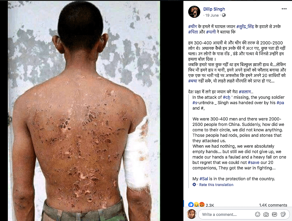 गलवान में घायल भारतीय जवान की है ये फोटो? वायरल फोटो का सच जानिए
