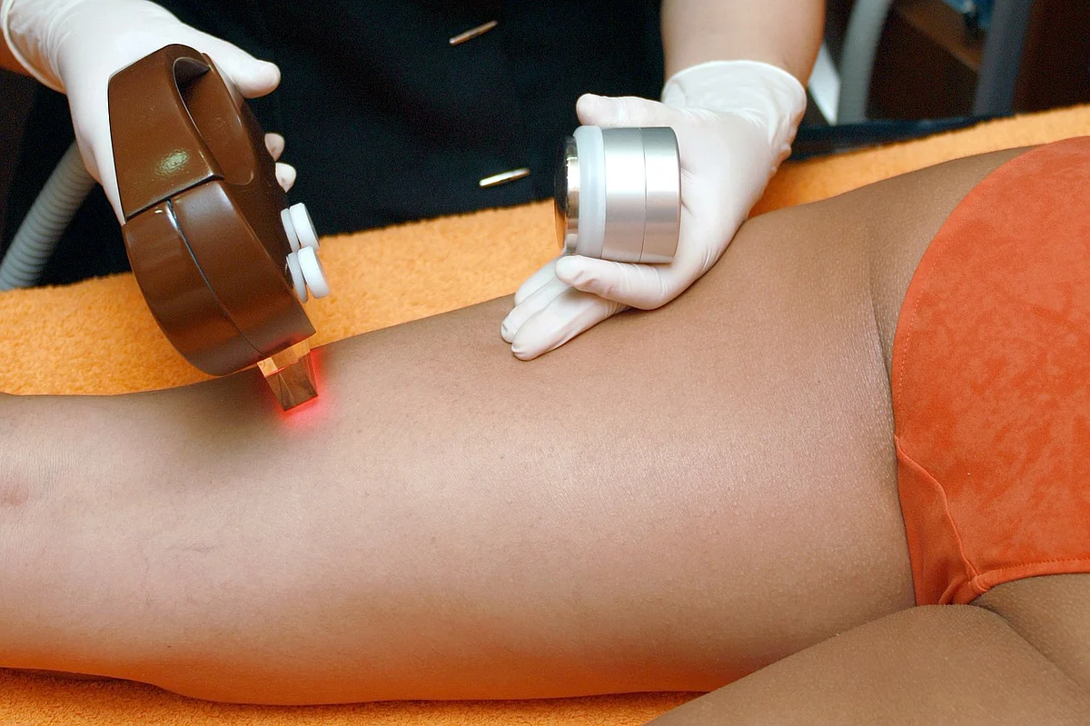 परमानेंट हेयर रिमूवल के लोकप्रिय तरीके - Permanent hair removal ke lokpriya tarike