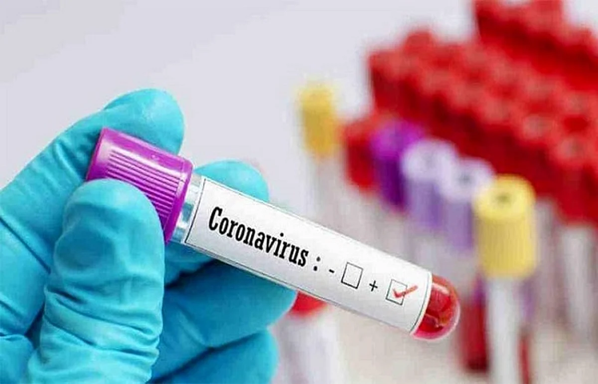 राजस्थान में कोरोना के 557 नए मरीज बढ़े, छह की मौत