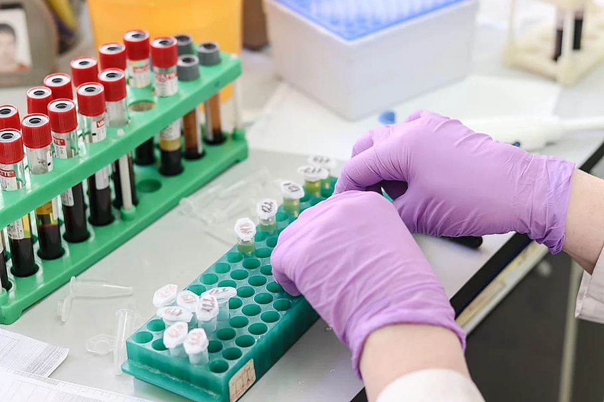 एमिनो एसिड यूरिन टेस्ट क्या है और ये कैसे होता है - Amino acids Urine Test in Hindi
