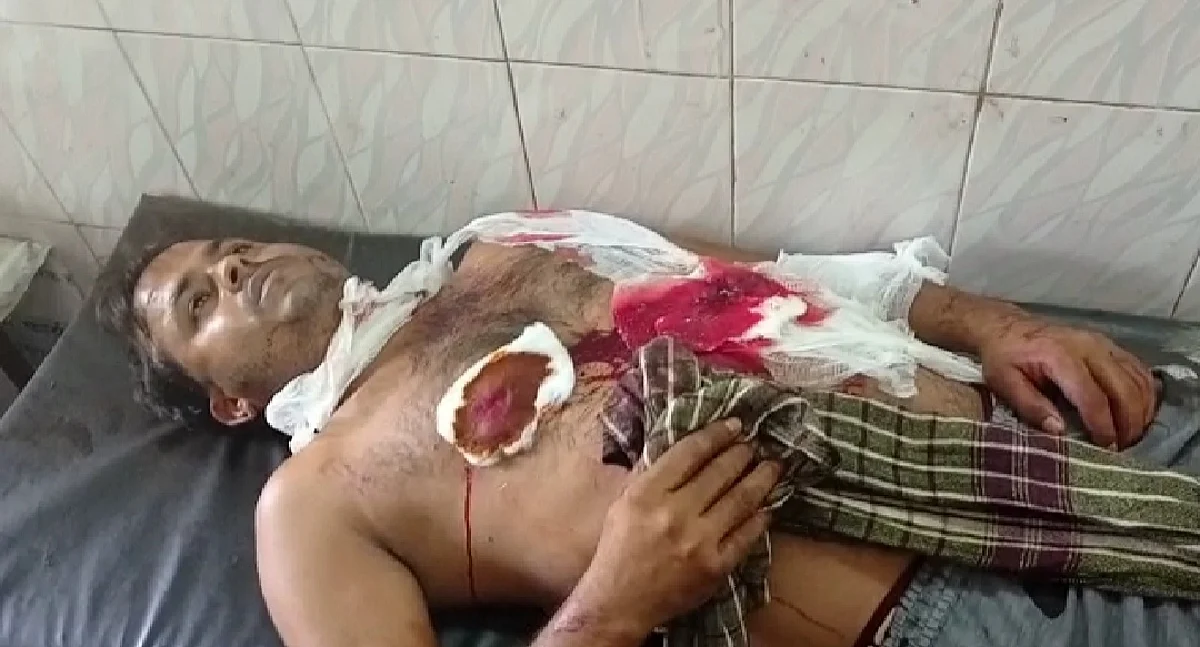 नशेड़ी ने युवक पर चाकू से किया जानलेवा हमला, स्थिति गंभीर